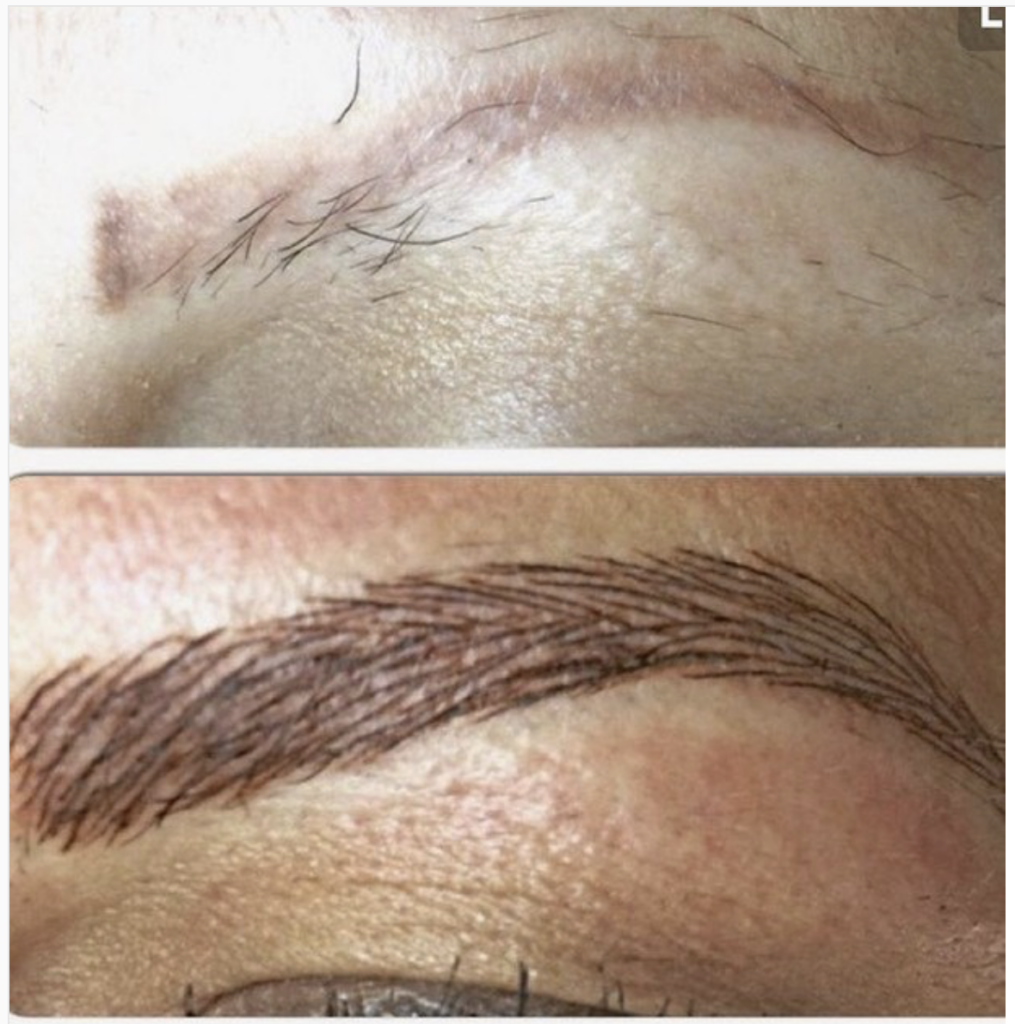 Before and After Microblading Schaumburg