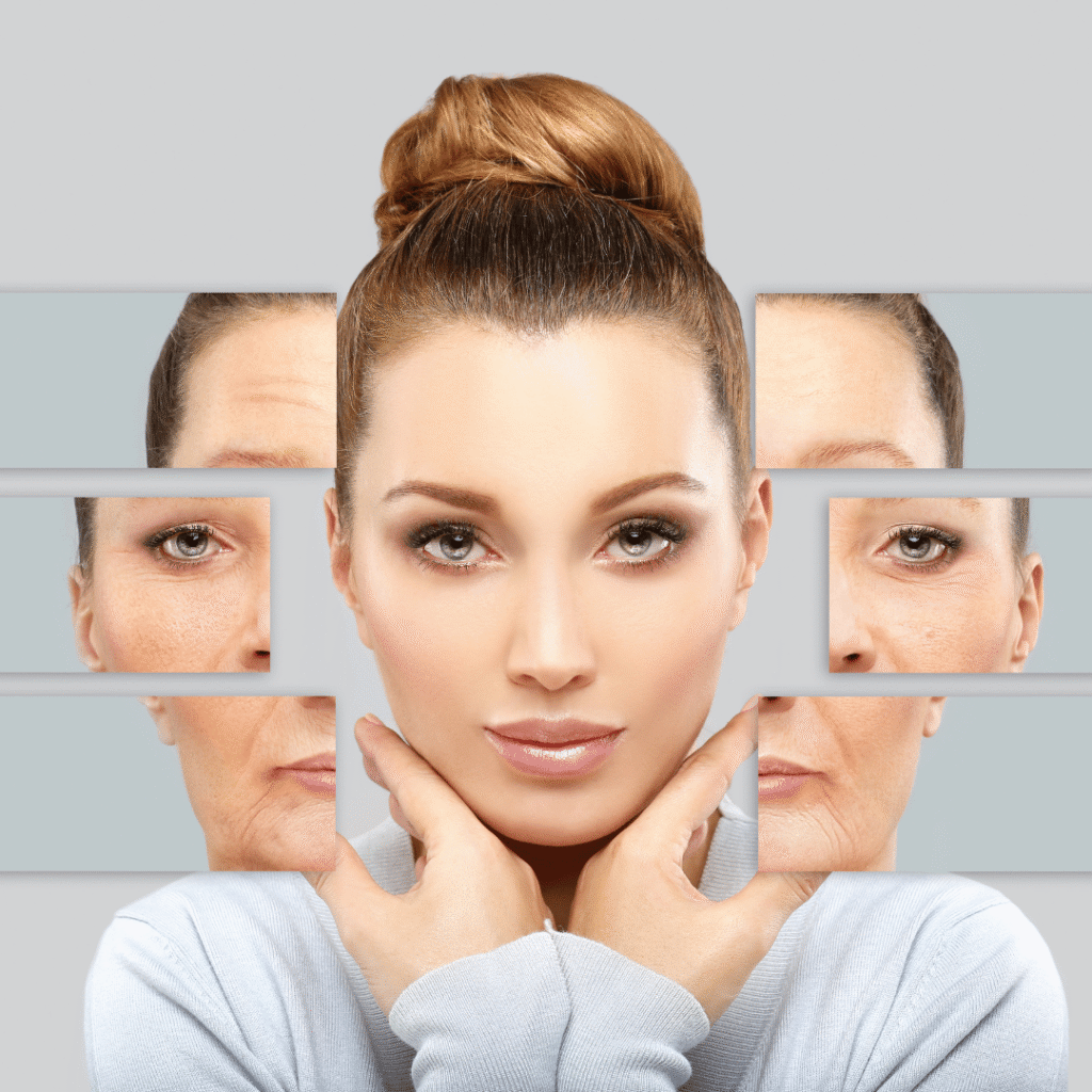 Botox Frequently Asked Questions