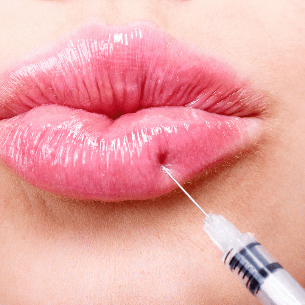 Botox Frequently Asked Questions
